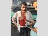 Himachal: Assault On HRTC Driver : ओवरटेकिंग को लेकर हुआ विवाद, एचआरटीसी वोल्वो बस के चालक को बुरी तरह पीटा; महिला समेत 4 गिरफ्तार
